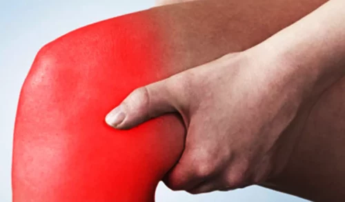 ACL Sprain: Facts and Treatment