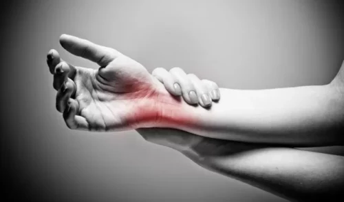 Carpal Tunnel Syndrome: Wrist Pain