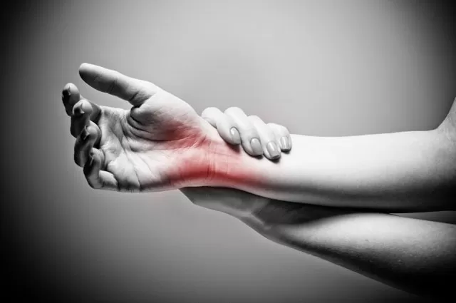 Carpal Tunnel Syndrome: Wrist Pain