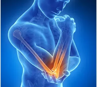 Lateral Epicondylitis: a.k.a Tennis Elbow