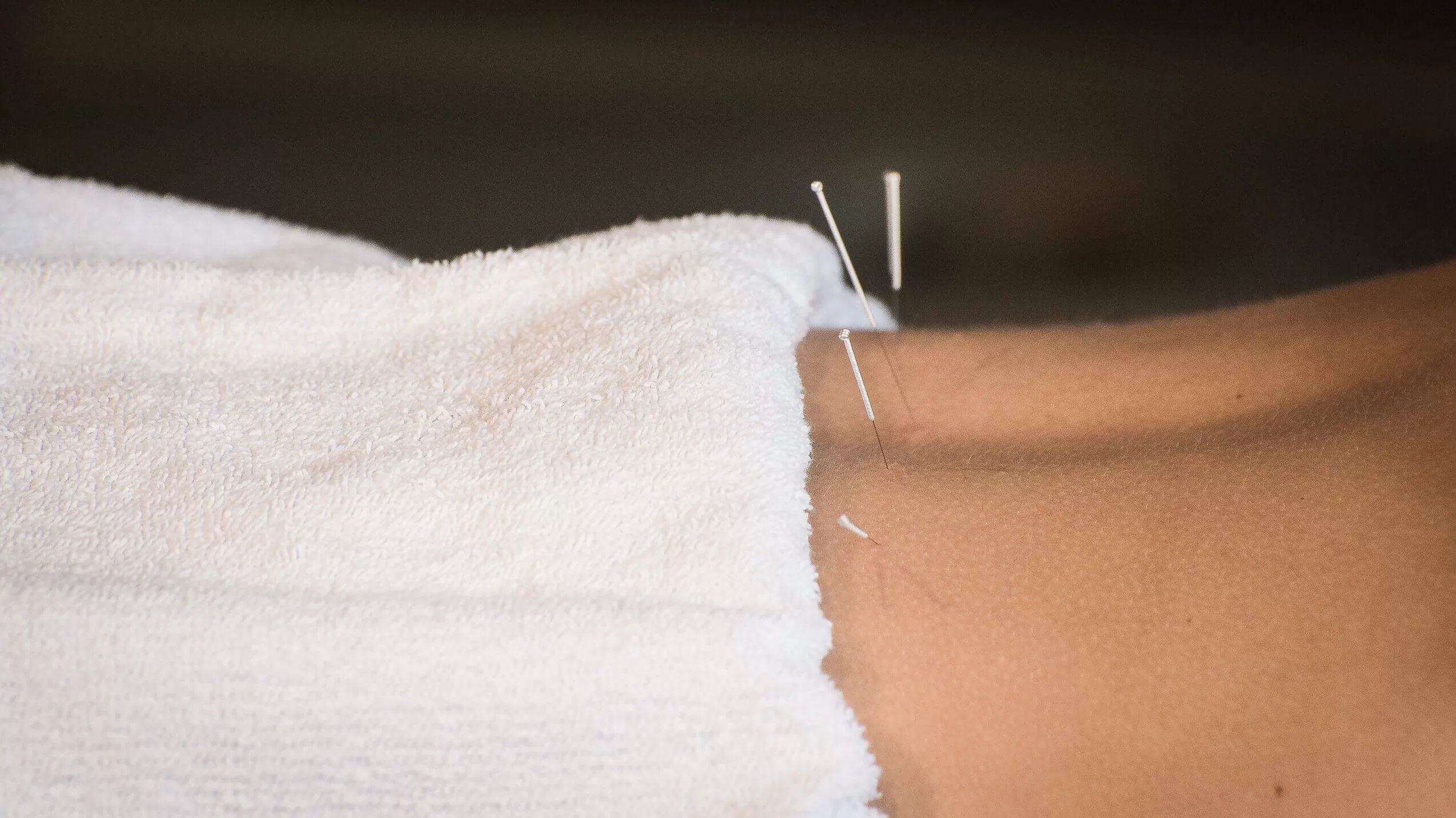 Acupuncture Treatment Near Me