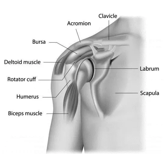 Shoulder Bursitis