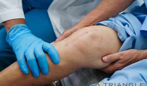 Post-Orthopedic Surgery Recovery: Unveiling the Significance of Physiotherapy