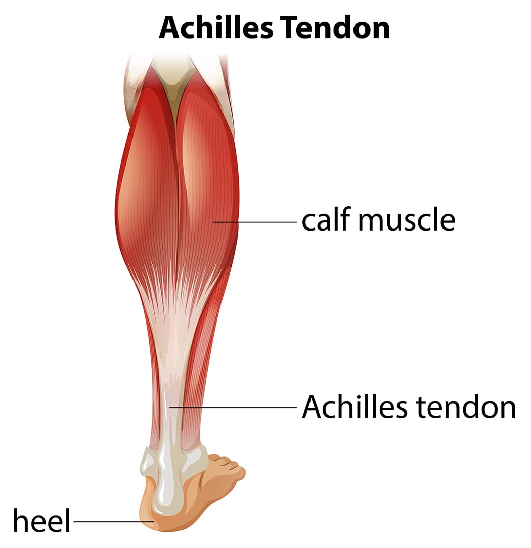 Achilles surgery rehab Toronto