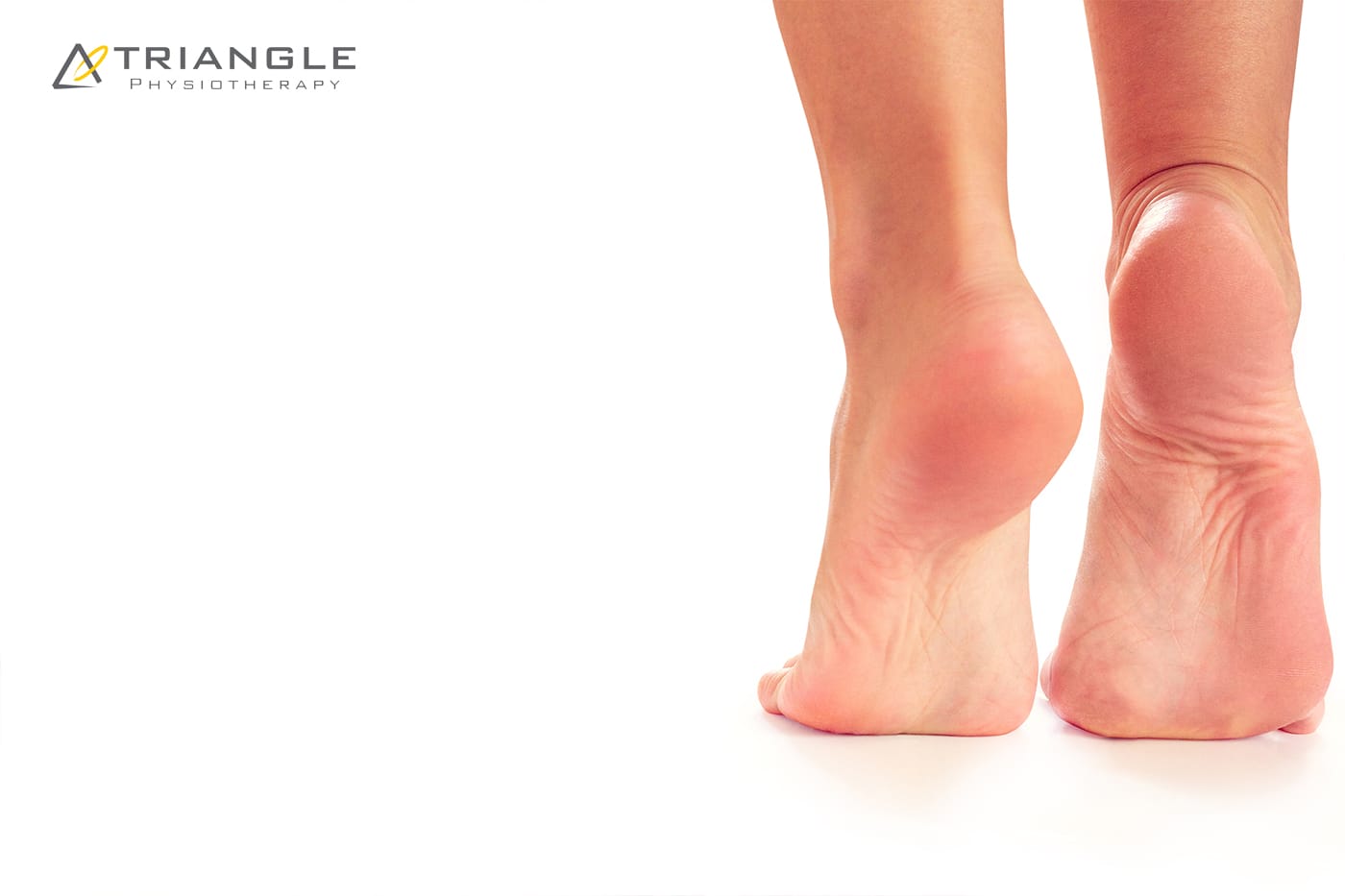 What Are Heel Spurs?