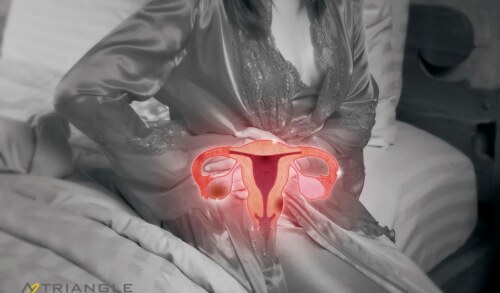 PCOS vs. Endometriosis: Understanding the Key Differences